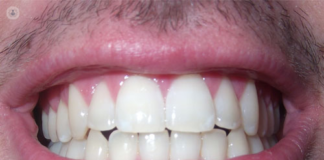 ¿Rechinas los dientes mientras duermes? Expertos advierten de este trastorno y explican sus principales causas