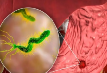 Científica chilena desarrolla probiótico que busca combatir la bacteria asociada al cáncer gástrico